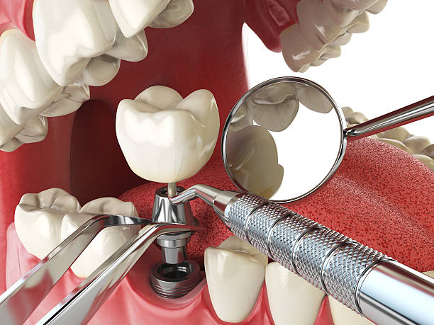 Best Emergency Dental Surgery in Tequesta, FL